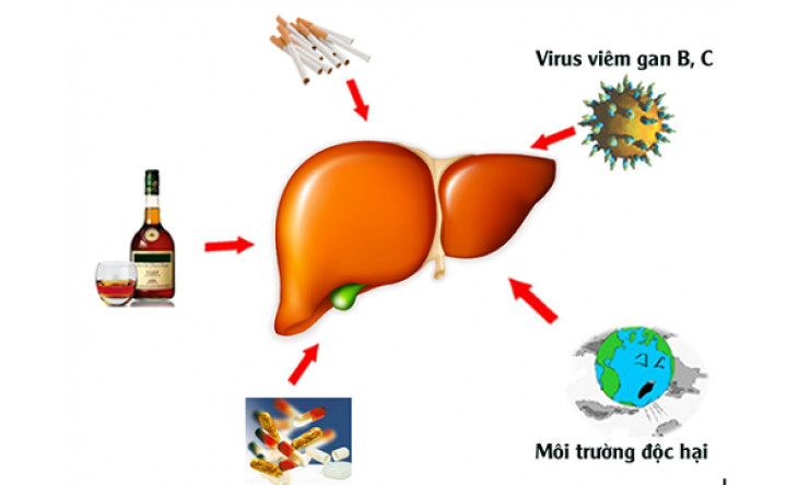 Cấp cứu vì gan ốm vẫn dùng paracetamol