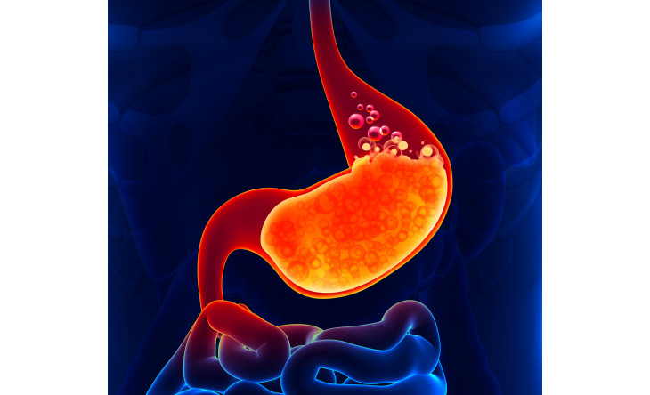 Acid mefenamic có thể ảnh hưởng nghiêm trọng đường tiêu hóa