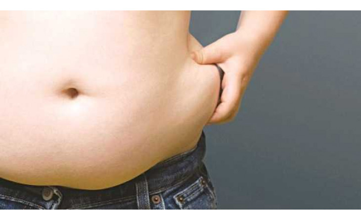 Bệnh béo phì và suy tĩnh mạch