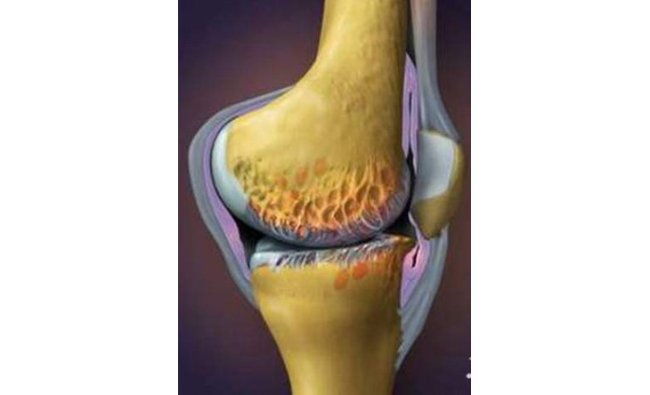 Glucosamin - Dùng sao cho đúng?