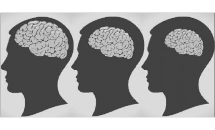 Các vùng não bị tổn thương khi nghiện rượu