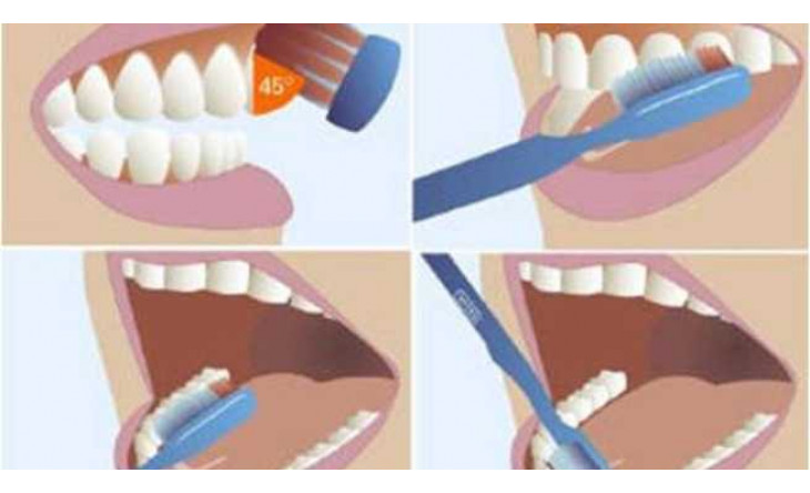 5 thói quen ảnh hưởng xấu tới răng miệng