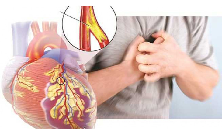 NHỮNG NGUY CƠ TRÊN TIM MẠCH KHI BỔ SUNG TESTOSTERONE!