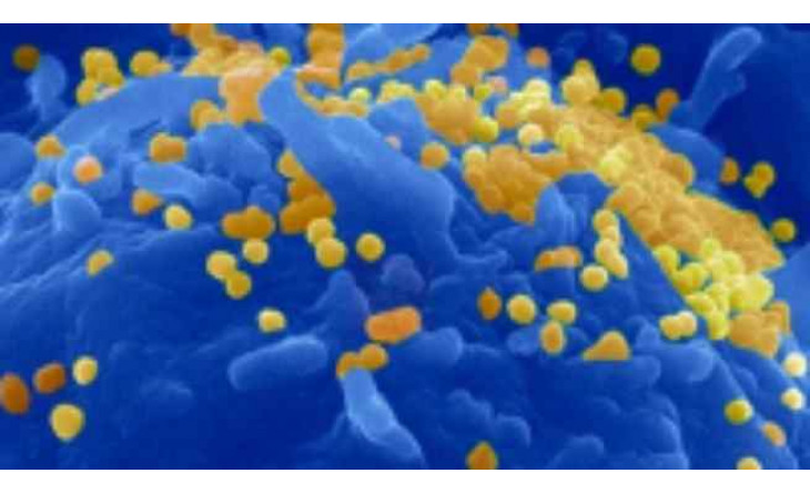 Các nhà khoa học khám phá bí ẩn lớn nhất của HIV