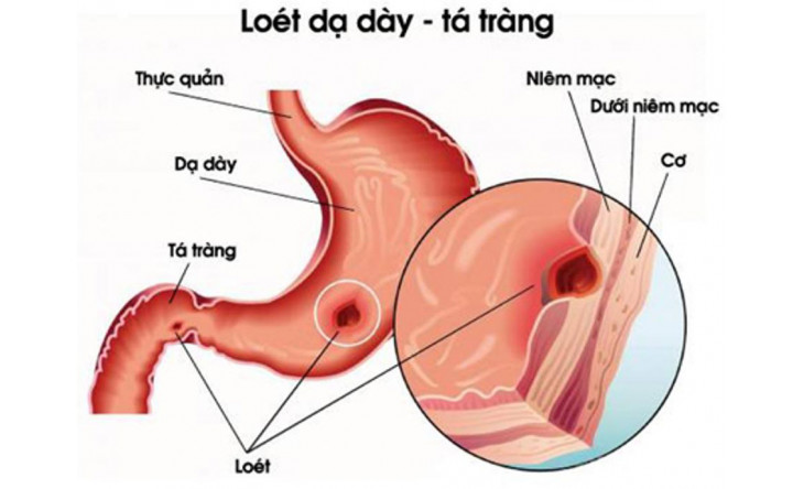 Lô hội - Cây thuốc quý