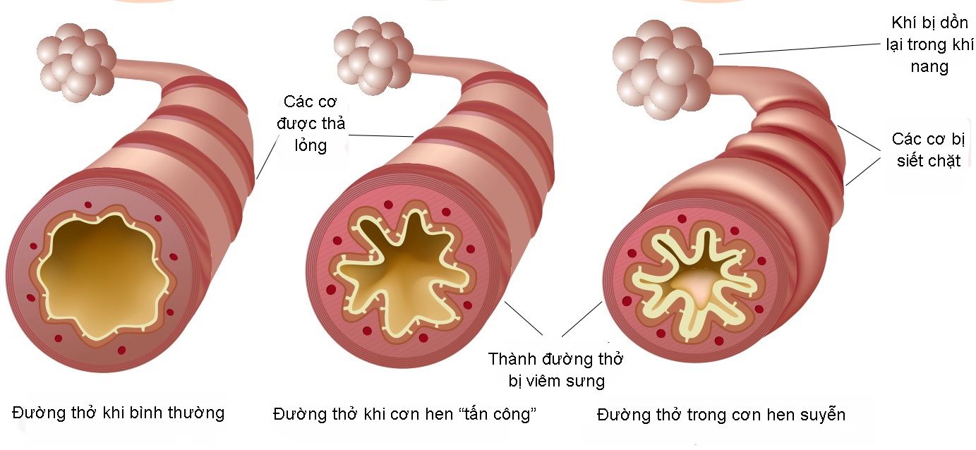 7. Tác động đến chất lượng cuộc sống