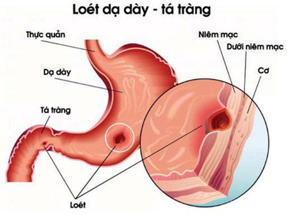 lohoi